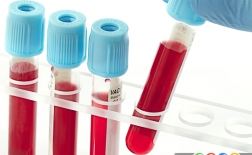 آزمایش خون استاندارد چیست؟