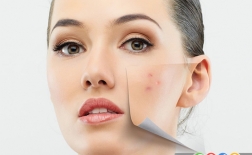 انواع روش های درمان لک های پوستی