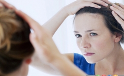 درمان ریزش مو بر اثر عدم تعادل هورمونی