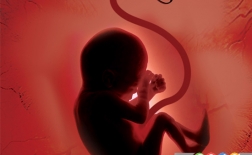انواع سقط جنین. چرا و چگونه ؟