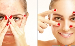 نکاتی درباره ی واکنش های آلرژیک به مواد آرایشی