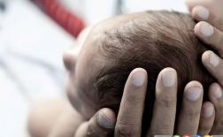 10 مورد عجیب اما عادی در نوزادان تازه متولد شده