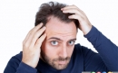 10 شایعه درباره ریزش مو که نباید باور کنید