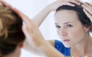 درمان ریزش مو بر اثر عدم تعادل هورمونی