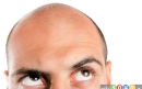 راه های موثر متوقف کردن ریزش مو در مردان 2