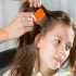 ریزش مو در کودکان