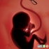 انواع سقط جنین. چرا و چگونه ؟