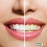 عوامل موثر بر تغییر رنگ دندان ها