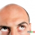 راه های موثر متوقف کردن ریزش مو در مردان 2