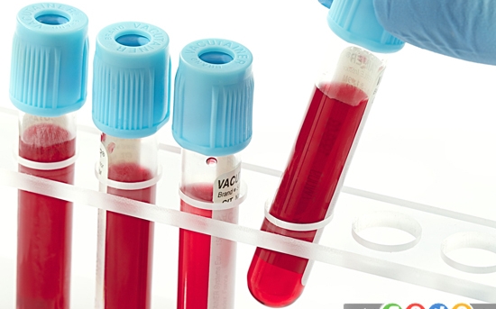آزمایش خون استاندارد چیست؟