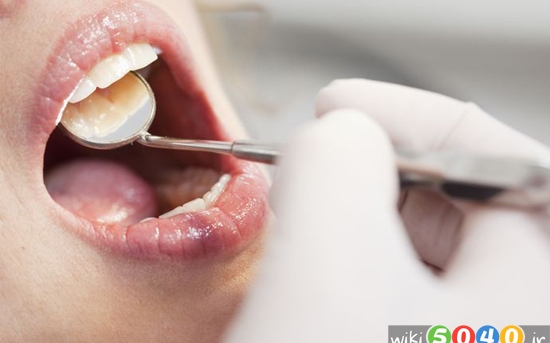 لیستی از مشکلات رایج دهان و دندان
